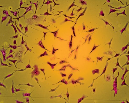 Adherent Cell