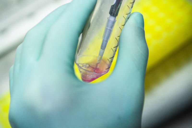 Laboratory cell separation experiments-4