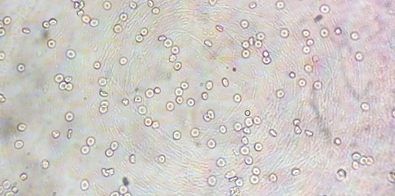 Cells under the microscope