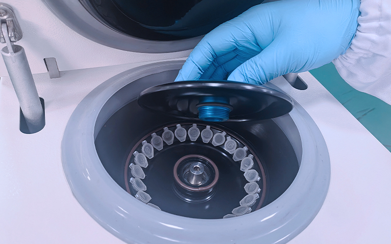 Laboratory personnel are opening the lid of the centrifuge's angle rotor Laboratory personnel are opening the lid of the centrifuge's angle rotor